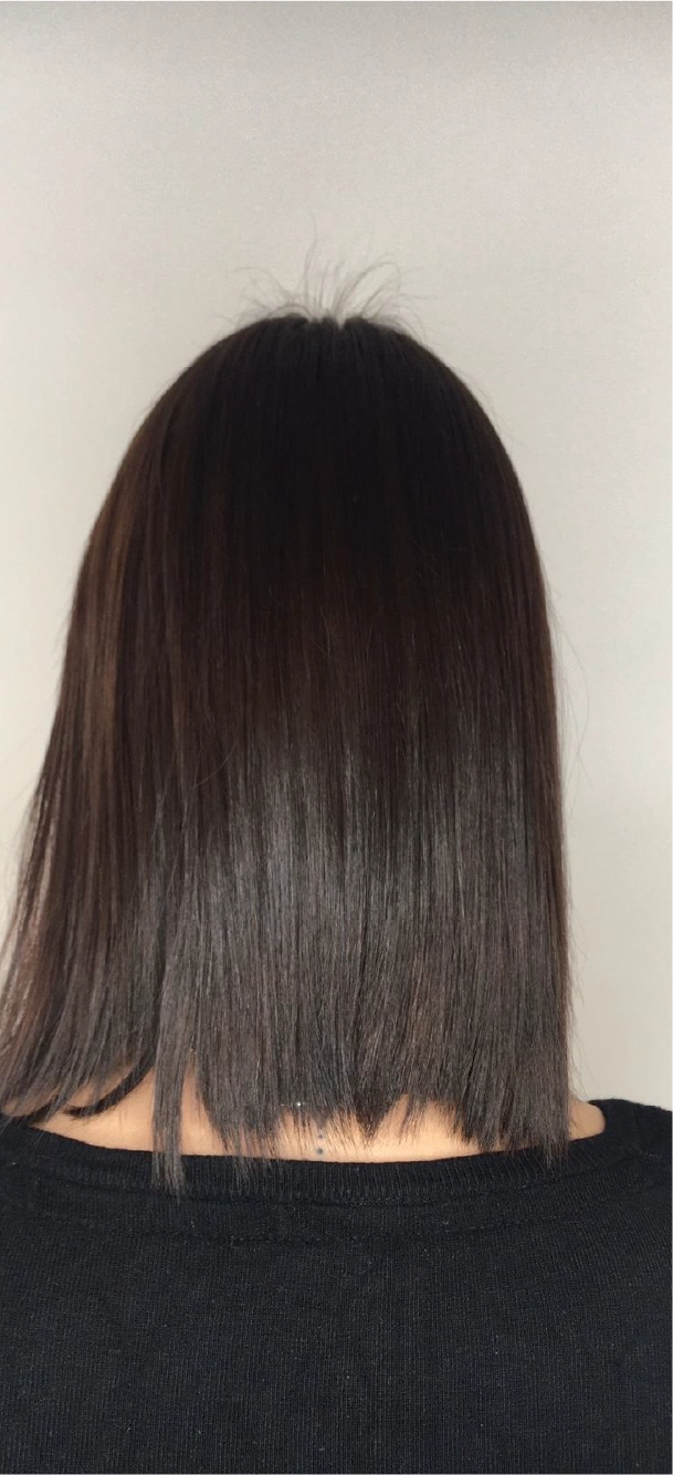 Extension